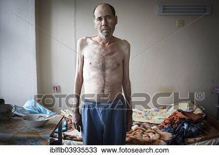 Stock Image - "Tuberculosis and HIV in Moldova, ward of the Chiril Draganiuc hospital, ChiÈ™inau, Moldova, Europe". Fotosearch