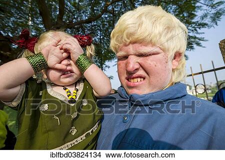 "Two albinos covering and closing their sensitive eyes from the sunlight, Bhavnagar, Gujarat, India, Asia" View Large Photo Image Picture - "Two albinos covering and closing their sensitive eyes from the sunlight, Bhavnagar, Gujarat, India, Asia". Fotosearch