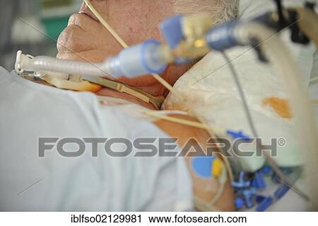 Stock Image - Elderly man lying in an intensive care unit, ICU, Germany, Europe. Fotosearch