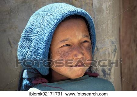 Girl with skin damaged by sunshine and dry air, Pidmo, Zanskar Valley, Ladakh, Jammu and Kashmir, Himalayas, North India, India, Asia View Large Photo Image Stock Image - Girl with skin damaged by sunshine and dry air, Pidmo, Zanskar Valley, Ladakh, Jammu and Kashmir, Himalayas, North India, India, Asia. Fotosearch