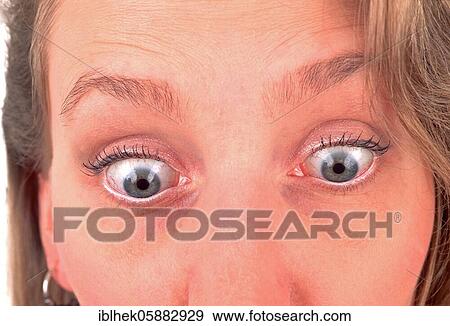 Blonde woman, eyes wide open, Berlin, Germany, Europe View Large Photo Image Stock Photo - Blonde woman, eyes wide open, Berlin, Germany, Europe. Fotosearch