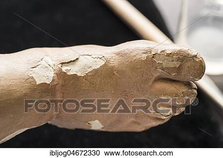 Stock Image - Restoration studio, splintered areas on the foot surface of angel figure, Munich, Bavaria, Germany, Europe. Fotosearch