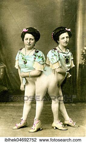 Stock Image - The Siamese twins Josefa and Rosa Blazek, 1910s, Bohemia, Germany, Europe. Fotosearch