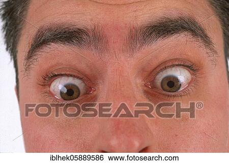 Stock Photograph - Grimace, eye area, man surprised, Berlin, Germany, Europe. Fotosearch