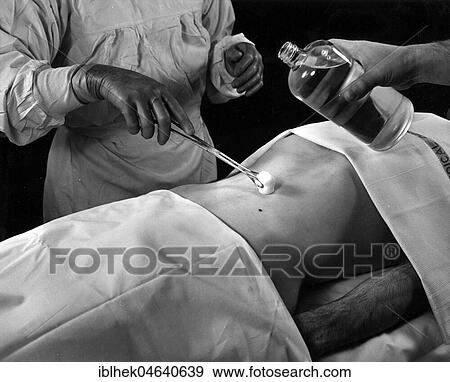 Stock Photo - Medicine, health, operation on the stomach, ca. 1940s, exact location unknown, Germany, Europe. Fotosearch
