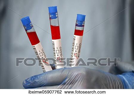 Positive test result, medical personnel using RT-PCR, real-time reverse transcriptase polymerase chain reaction, corona test, corona crisis, Baden-Württemberg, Germany, Europe View Large Photo Image Stock Image - Positive test result, medical personnel using RT-PCR, real-time reverse transcriptase polymerase chain reaction, corona test, corona crisis, Baden-Württemberg, Germany, Europe. Fotosearch