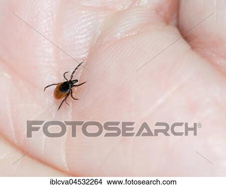 Castor Bean Tick (Ixodes ricinus) crawling over a man's skin, Lower Saxony, Germany, Europe View Large Photo Image Picture - Castor Bean Tick (Ixodes ricinus) crawling over a man's skin, Lower Saxony, Germany, Europe. Fotosearch