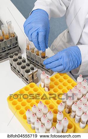 Preparation of blood samples for examination in the fully automatic machine for clinical chemistry and immunology, hospital laboratory, North Rhine-Westphalia, Germany, Europe View Large Photo Image Stock Photo - Preparation of blood samples for examination in the fully automatic machine for clinical chemistry and immunology, hospital laboratory, North Rhine-Westphalia, Germany, Europe. Fotosearch