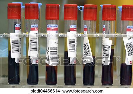 Picture - Blood samples in medical laboratory, Hamburg, Germany, Europe. Fotosearch