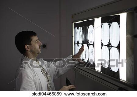 Evaluation of radiographs, Dominikus Hospital, Düsseldorf, North Rhine-Westphalia, Germany, Europe View Large Photo Image Stock Photo - Evaluation of radiographs, Dominikus Hospital, Düsseldorf, North Rhine-Westphalia, Germany, Europe. Fotosearch