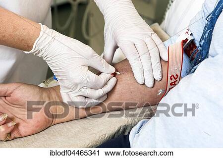 Stock Image - Outpatient dialysis, doctor inserting cannula, North Rhine-Westphalia, Germany, Europe. Fotosearch