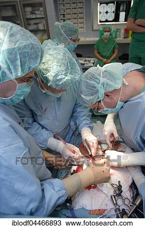Surgery, doctor, team, hospital, vascular surgery, Germany, Europe View Large Photo Image Stock Image - Surgery, doctor, team, hospital, vascular surgery, Germany, Europe. Fotosearch