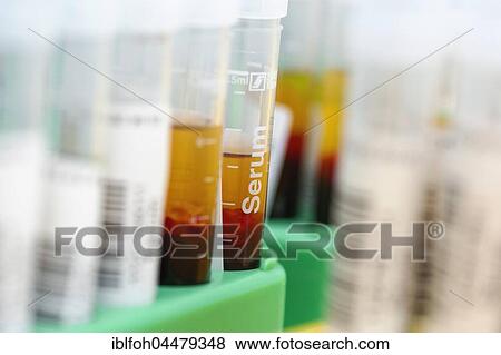 Tubes with blood samples for laboratory study, North Rhine-Westphalia, Germany, Europe View Large Photo Image Stock Photo - Tubes with blood samples for laboratory study, North Rhine-Westphalia, Germany, Europe. Fotosearch