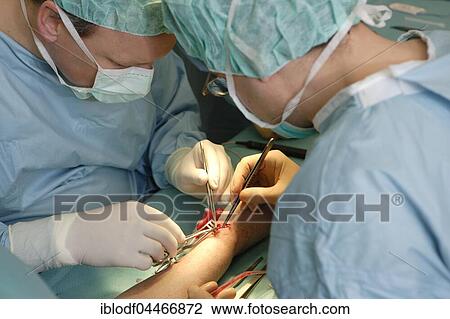 Vascular surgery, surgery on the hand, Düsseldorf, North Rhine-Westphalia, Germany, Europe View Large Photo Image Stock Image - Vascular surgery, surgery on the hand, Düsseldorf, North Rhine-Westphalia, Germany, Europe. Fotosearch