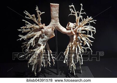 Plastinate, bronchial tree of human lungs, Body Worlds, Menschen Museum, Berlin, Germany, Europe View Large Photo Image Stock Photo - Plastinate, bronchial tree of human lungs, Body Worlds, Menschen Museum, Berlin, Germany, Europe. Fotosearch