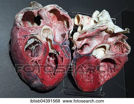 Plastinate, cross section of human heart, Body Worlds, Menschen Museum, Berlin, Germany, Europe View Large Photo Image Stock Photo - Plastinate, cross section of human heart, Body Worlds, Menschen Museum, Berlin, Germany, Europe. Fotosearch