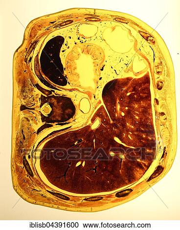 Plastinate, cross section through human abdomen, Body Worlds, Menschen Museum, Berlin, Germany, Europe View Large Photo Image Stock Image - Plastinate, cross section through human abdomen, Body Worlds, Menschen Museum, Berlin, Germany, Europe. Fotosearch