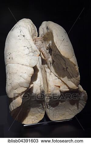 Stock Image - Plastinate, healthy human lung, Body Worlds, Menschen Museum, Berlin, Germany, Europe. Fotosearch
