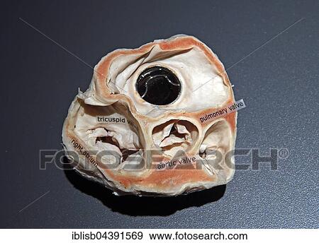 Stock Photo - Plastinate, human heart with artificial heart valve, Body Worlds, Menschen Museum, Berlin, Germany, Europe. Fotosearch