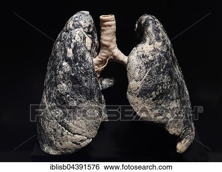 Stock Photograph - Plastinate, human lung, smoker, Body Worlds, Menschen Museum, Berlin, Germany, Europe. Fotosearch