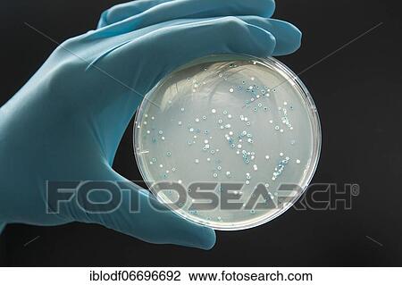 Stock Image - Petri dish with a transformation of (E. ) coli bacteria. Fotosearch