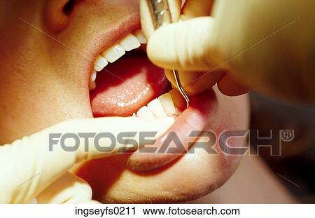 Dental Appointment View Large Photo Image Stock Image - Dental Appointment. Fotosearch