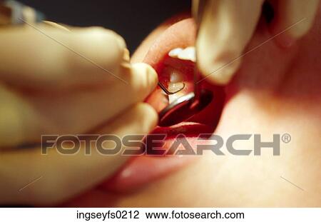 Dental Appointment View Large Photo Image Stock Image - Dental Appointment. Fotosearch