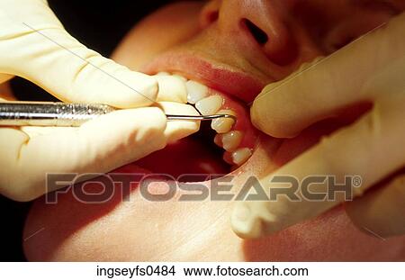 Dental Visit View Large Photo Image Picture - Dental Visit. Fotosearch