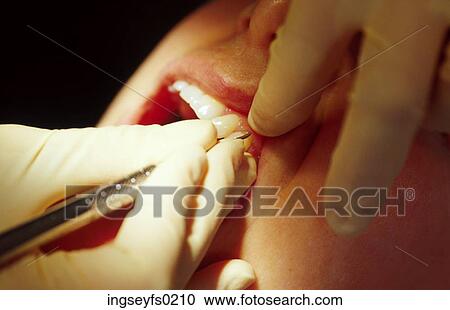 Dental Visit View Large Photo Image Stock Image - Dental Visit. Fotosearch