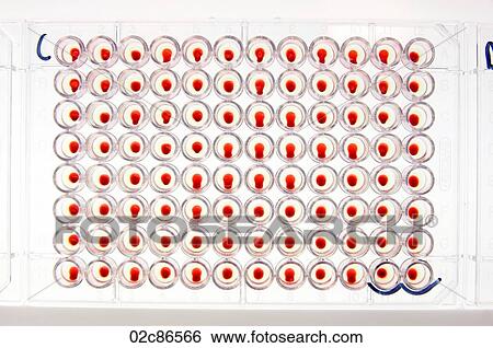 Blood samples in lab clinic. View Large Photo Image Stock Photograph - Blood samples in lab clinic.. Fotosearch