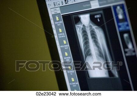 Display of diagnostic viewer. View Large Photo Image Stock Image - Display of diagnostic viewer.. Fotosearch