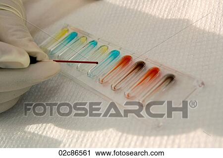 Stock Image - Lab technician doing blood type experiment.. Fotosearch