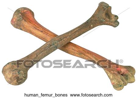 Human femur bones View Large Photo Image Stock Photograph - Human femur bones. Fotosearch