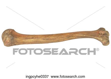 Stock Photo - Human femur bone . Fotosearch