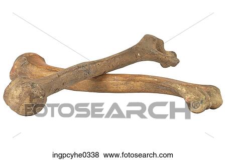 Stock Photo - Human femur bones . Fotosearch