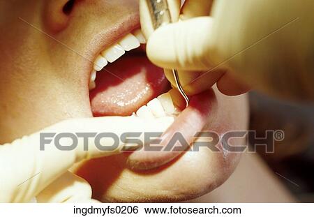 Dental Appointment View Large Photo Image Stock Photograph - Dental Appointment. Fotosearch