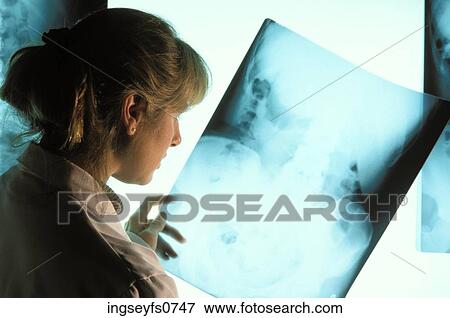 Doctor and X-Ray View Large Photo Image Stock Photo - Doctor and X-Ray. Fotosearch