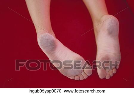 Close-up of the soles of a person's feet View Large Photo Image Stock Image - Close-up of the soles of a person's feet. Fotosearch