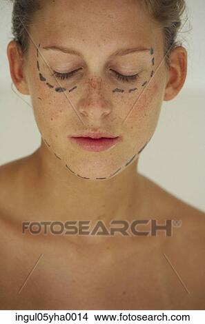 Young woman with guide markings for cosmetic surgery View Large Photo Image Picture - Young woman with guide markings for cosmetic surgery. Fotosearch