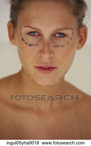 Young woman with guide markings for cosmetic surgery View Large Photo Image Stock Photo - Young woman with guide markings for cosmetic surgery. Fotosearch