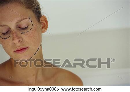Young woman with guide markings for cosmetic surgery View Large Photo Image Stock Photography - Young woman with guide markings for cosmetic surgery. Fotosearch