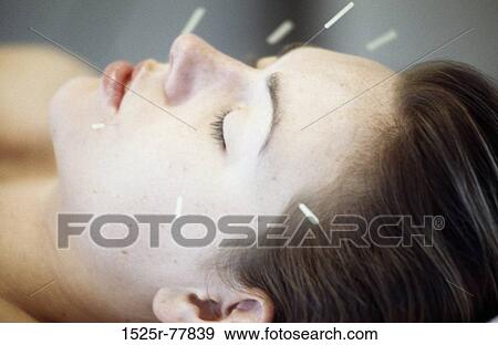 people, woman, face, acupuncture, health, alternative View Large Photo Image Stock Photo - people, woman, face, acupuncture, health, alternative. Fotosearch