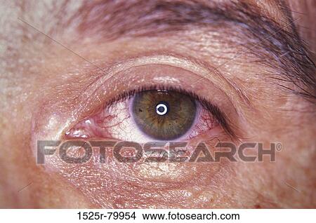 Close-up of a man's eye View Large Photo Image Picture - Close-up of a man's eye. Fotosearch