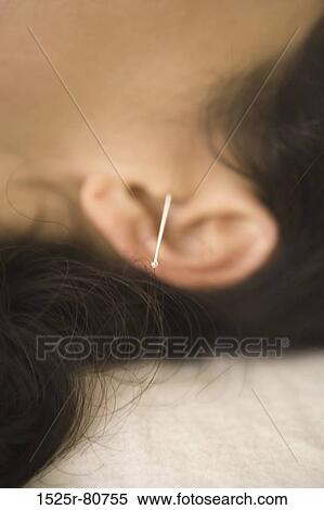 Close-up of a woman receiving acupuncture treatment View Large Photo Image Stock Photography - Close-up of a woman receiving acupuncture treatment. Fotosearch