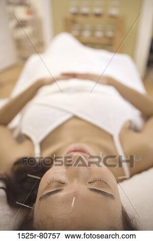 Close-up of a young woman receiving acupuncture treatment View Large Photo Image Stock Photo - Close-up of a young woman receiving acupuncture treatment. Fotosearch
