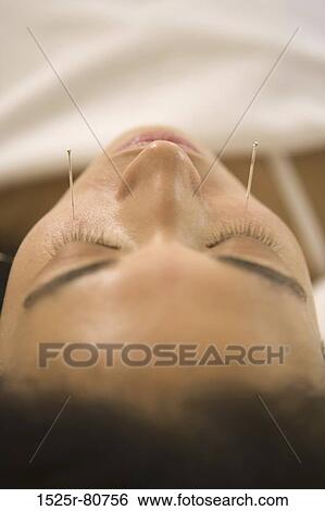 Close-up of a young woman receiving acupuncture treatment View Large Photo Image Stock Photograph - Close-up of a young woman receiving acupuncture treatment. Fotosearch