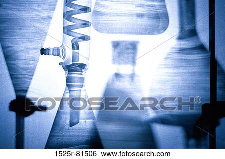 Close-up of the apparatus in a laboratory View Large Photo Image Stock Photograph - Close-up of the apparatus in a laboratory. Fotosearch