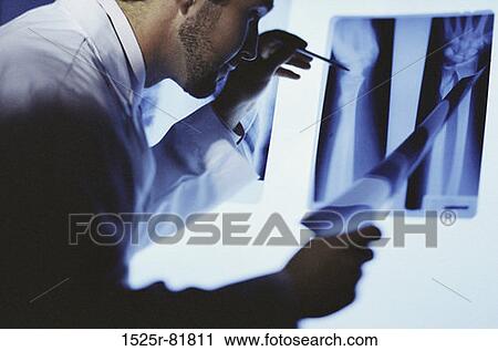 Stock Image - Male doctor examining an X-ray. Fotosearch