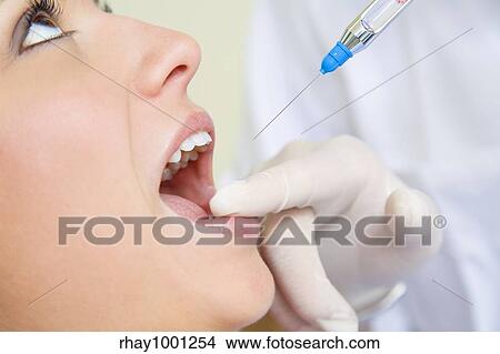 dentist holding a syringe and anesthetizing his patient. Close-up of mouth open View Large Photo Image Picture - dentist holding a syringe and anesthetizing his patient. Close-up of mouth open. Fotosearch