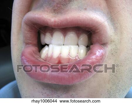 this is the mouth of someone that is not having the best of days View Large Photo Image Picture - this is the mouth of someone that is not having the best of days. Fotosearch